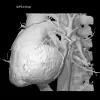 فایل سه بعدی قلب انسان
