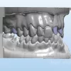 مدل3بعدی دهان و دندان