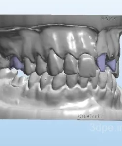 مدل3بعدی دهان و دندان