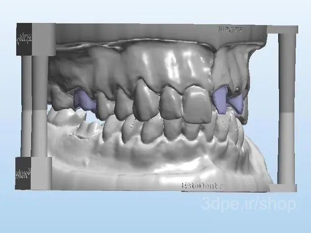 مدل3بعدی دهان و دندان