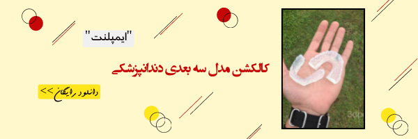 فایل سه بعدی ایمپلنت